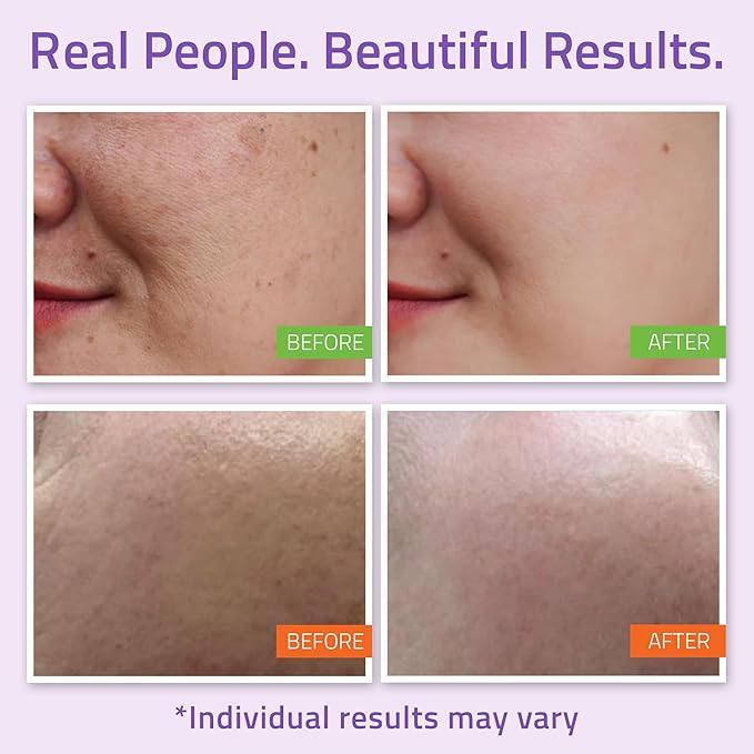 YEOUTH Skin Care Set: Hyaluronic Acid Serum for Face, Vitamin C Serum, Facial Toner, Under Eye Gel, Face Cream, Skin Care Kit for Women & Men 5-Piece