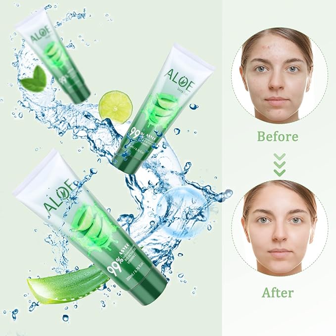 200x2 ML Aloe Vera Gel – 99% Organic Pure Aloe Vera Hydrating Face & Body Moisturizer, Natural Aloe Cream for Dry Skin, Sunburn, Acne, Soothing & Moisturizing