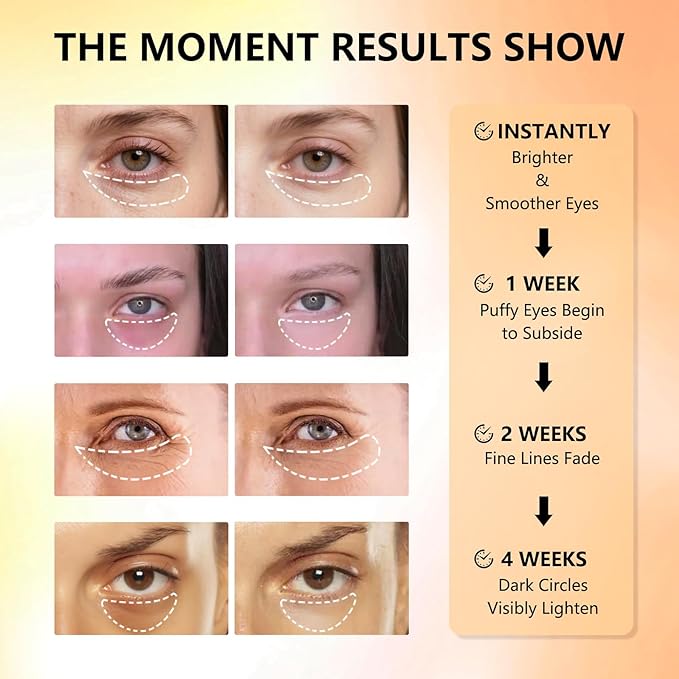 Under Eye Patches with Vitamin C & Caffeine 30 Pairs for Dark Circles, Fine Lines and Puffiness, with Niacinamide Hydra-Gel Collagen, Skin Care for Men & Women