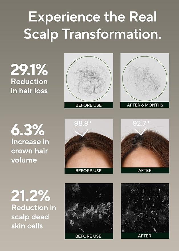 AROMATICA Rosemary Salt Scrub Shampoo - Hair Loss Korean Scalp Detox Shampoo with Rosemary Scalp Oil | Scalp Exfoliator with Salt Scrub for Oily Scalp | Sulfate Free, Silicone Free (10.5 oz / 300g)