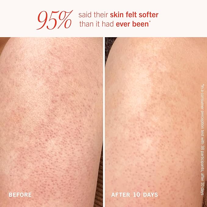 First Aid Beauty Smooth + Juicy Body Scrub Kit: KP Bump Eraser Body Scrub with 10% AHA, Daily Exfoliation Keratosis Pilaris Set to Help Reduce Chicken Skin Bumps; Strawberry, Peach, & Original (2 oz)