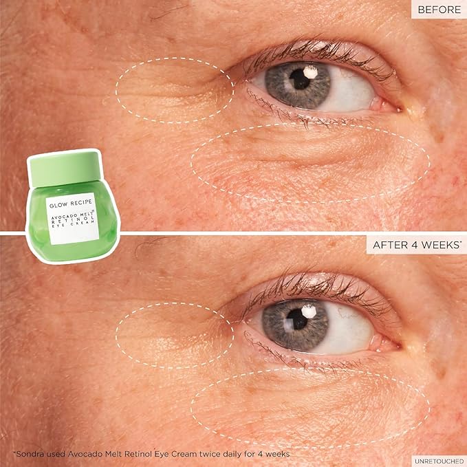 Glow Recipe Avocado Retinol Eye Cream for Wrinkles - Overnight Under Eye Cream for Dark Circles, Firming & Brightening Dull, Puffy Eyes - Time Release Niacinamide & Caffeine Eye Cream (15ml)