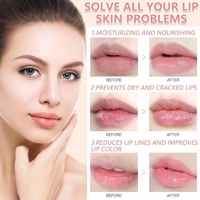 3PCS Bee Lip Balm Honey Pot,Honey Strawberry Watermelon Lip Mask Overnight Moisturizing Lip Balm,Hydrating Prevention Dry & Cracked Nourishing Sleeping Lip Mask (Honey+Strawberry+Watermelon)