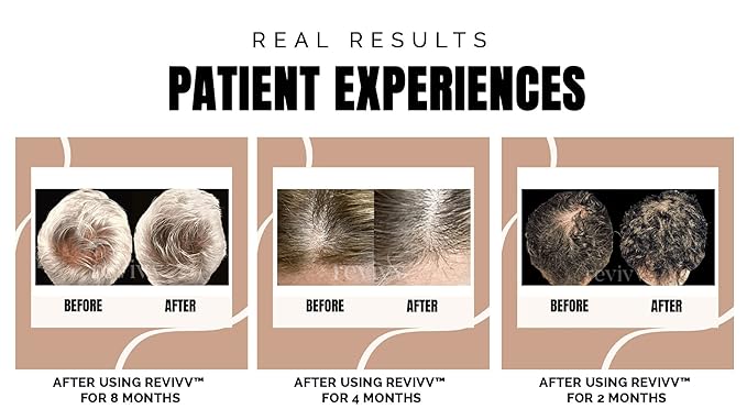 REVIVV Women Hair Growth Serum, 100% Natural Growth Products, Topical Solution for Visibly Thicker & Fuller Hair, Dermatologist Recommended, 1-Pack, 1oz Bottle, 45-Day Supply