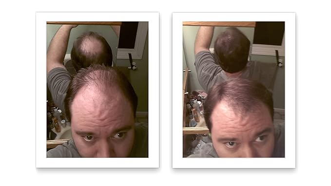 Quick Fix For Thinning Hair and Bald Spot. Get 10X Fuller Hair Instantly. All-Natural Hair Building Fiber For Hair. Trial Size (10-Day Supply). Light Brown