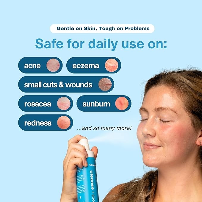 Hypochlorous Acid Spray – Eyelid Cleanser, HOCl Face & Skin Mist for Acne, Eczema & Irritation – Multi-Purpose Skin Repair – Post-Workout, Scalp & Sensitive Skin, Travel Size - 2 oz