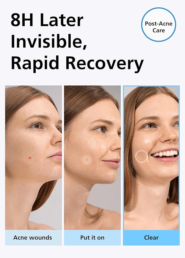 EasyDerm Beauty Patch(42 Counts) - 100% Hydrocolloid Pimple Patch for Zit Spot Care, K-beauty, Daewoong Pharmaceutical