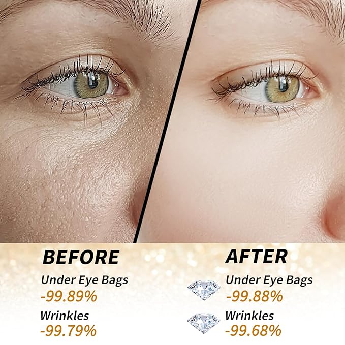 Golden Glow Under Eye Patches for Puffy Eyes - 60Pcs Eye Gels Rejuvenating Treatment for Dark Circles, Puffiness, Refreshing,Revitalizing Looks Less Tired