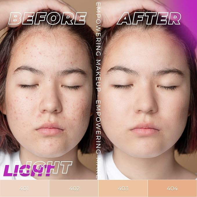 LAMEL OhMy Clear Face Full Coverage Foundation - Acne Coverage - Salicylic Acid & Tea Tree Extract - Dewy & Flawless Finish - Sensitive Skin Care - Organic & Oil-Free - 402, 1.35 fl.oz