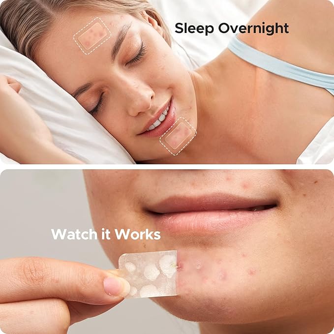 Large Acne Patches for Face, 7 Sizes Big Pimple Patches, XL Hydrocolloid Bandages for Body, Chin, Forehead, Nose, Back Blemish Zit Breakouts, Hydrocolloid Patch (Square, Strip, Dot 142 Count)