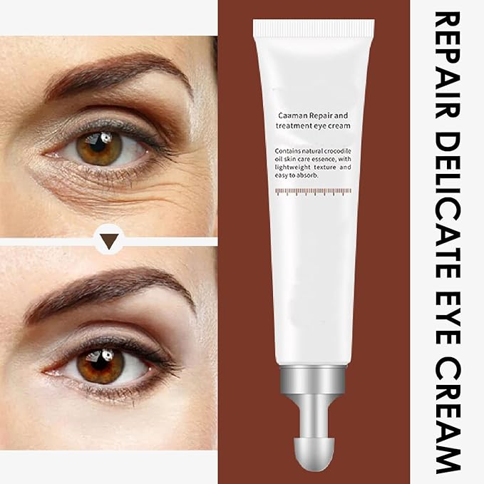 Eye Cream, STCORPS7 Vibrant Glamour Silk Protein Anti-Wrinkle And Firming Eye Cream For Wrinkles, Fine Lines, Dark Circles, Puffiness & Bags, 20g