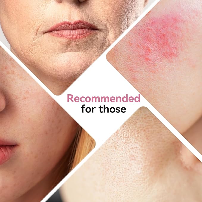 ISTON Bio-Collagen Face Mask,Overnight Revitalizing Hydrating Face Mask for Glowing Skin | Visible Firming, Deep Hydration & Refined Pores | Peptides, NMN & Hyaluronic Acid Masks For All Skin Type