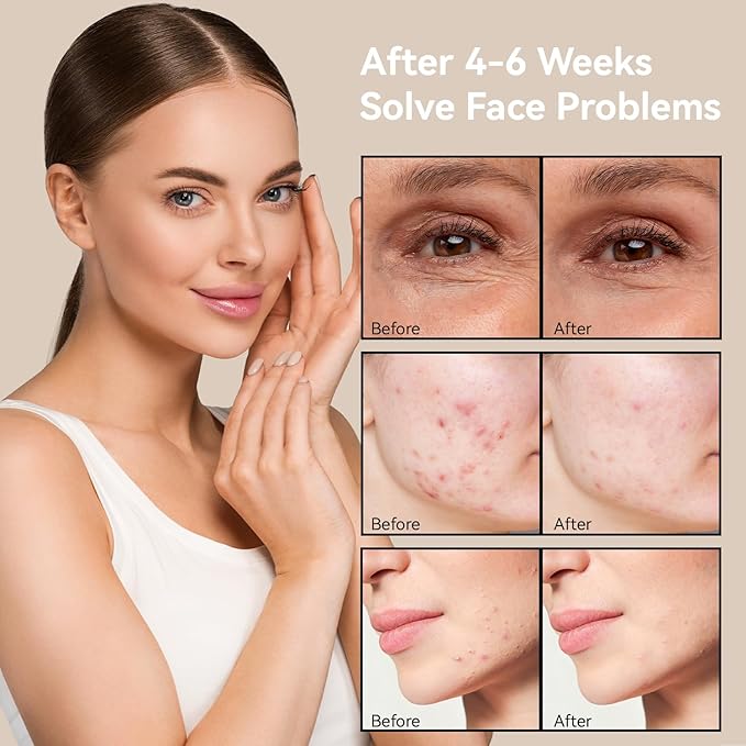 7 Colors Led Light Therapy Facial Mask, Face Light Therapy Mask for Face, Reduce Wrinkles Smooth Skin, Infrared Light Skin Rejuvenation