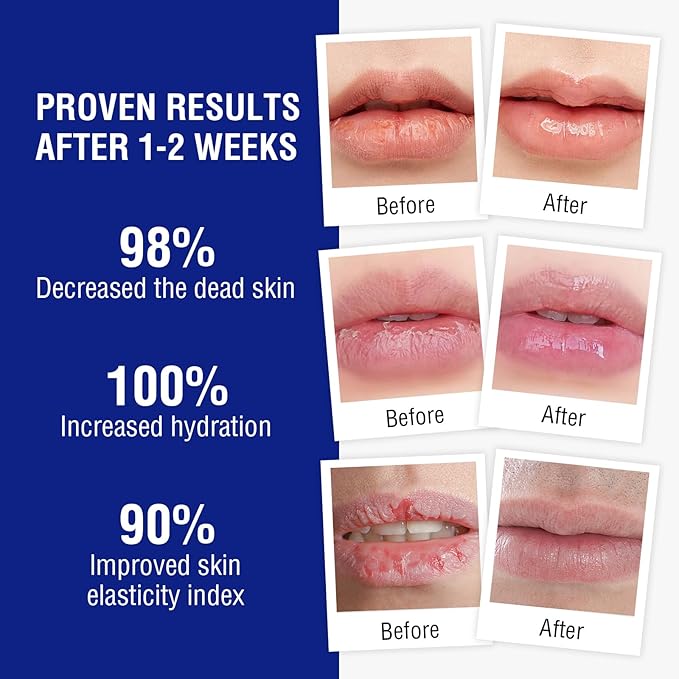 Lip Balm Treatment with Beeswax, Peppermint Oil,Natural Formula Lip Balm with Vitamin E & C Lips Daily Conditioning 24 hrs Long-lasting Moisture, Gentle Exfoliation Prevent Dryness & Chapping