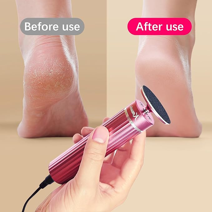 5.3'' Electric Foot Callus Remover with 80pcs Sandpaper Discs & Brush, Professional Aluminum Ergonomic Pedicure Tool, Stepless Speed & Reverse Control for Dead Skin Removal (Pink)