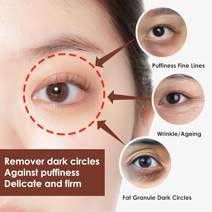 Eye Cream, STCORPS7 Vibrant Glamour Silk Protein Anti-Wrinkle And Firming Eye Cream For Wrinkles, Fine Lines, Dark Circles, Puffiness & Bags, 20g