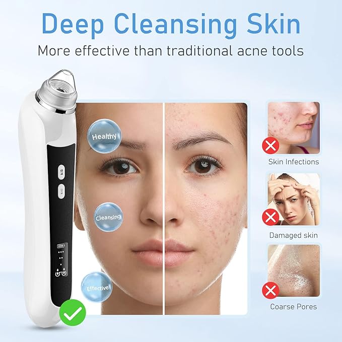 Facial Pore Blackhead Remover Vacuum, 1080P Camera Blackhead Remover, 20x Zoom, 8 LEDs ＆ 3 Suction Modes, 800mAh Battery & USB - 6 Heads Pore Cleaner Kit for Women&Men(Black)