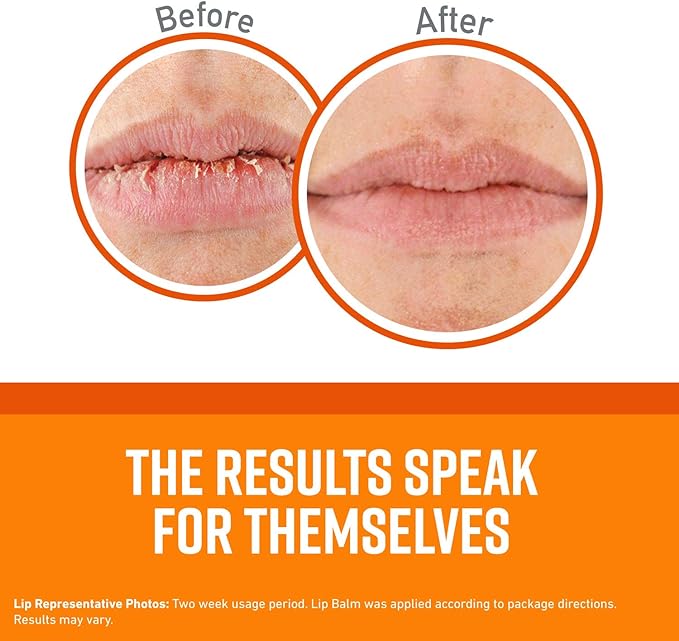 O'Keeffe's Unscented Lip Repair Lip Balm for Dry, Cracked Lips, Stick, (Pack of 3)