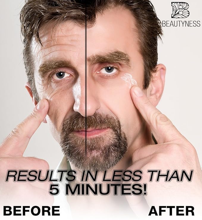 Instant Ageless Eye Cream – Anti Wrinkle Cream, Removes Under Eye Puffiness, Bags, Expression Lines, & Dark Circles. Powerfully Tighen & Lifts Sagging Skin. Disappears Before Your Eyes In Minutes.