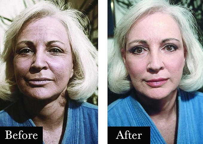 Boyd's Renoir No Lines Temporary Wrinkle Remover- For Forehead, Eyes, Lips, 0.5 fl oz (4 pack)