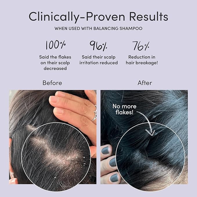 Jupiter, Physician-Formulated Scalp Balancing Conditioner for Dry, Itchy, Oily, Flaky Scalp, Sulfate-Free, Natural Fragrance, Vegan, Color-Safe, & Paraben-Free Conditioner for Women & Men