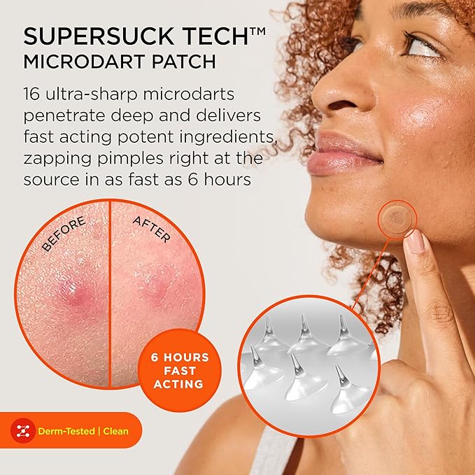 ZitSticka Killa Pimple Patches for Face - World's Most Potent Pimple Patch with Fast-Acting Microdarts - Starts Working within 6 Hours for Deep, Early-Stage Zits - Mini 16 Count