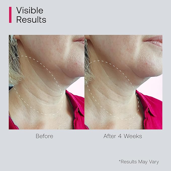 Retinol Neck Firming Cream with Cooling & Massaging Roller Applicator - Hydrates, Lifts, Smoothes Wrinkles, Fine Lines & Tightens Sagging Skin with Niacinamide & Hyaluronic Acid, 1.7oz/50g