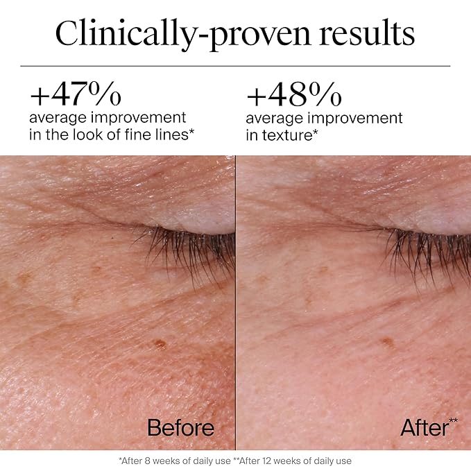 Neutrogena Rapid Wrinkle Repair Retinol Face Moisturizer, Daily Anti-Aging Face Cream with Retinol & Hyaluronic Acid to Fight Fine Lines, Wrinkles, & Dark Spots, 1.7 oz