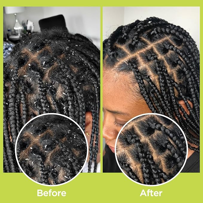 Rosemary & Apple Scalp Exfoliating Tonic - Scalp Detox Serum Deep Cleansing & Clarifying Treatment for Buildup, Dry Flaky Scalps - Soft Silicone Hair Scalps Massager Shampoo Brush for All Hair Types