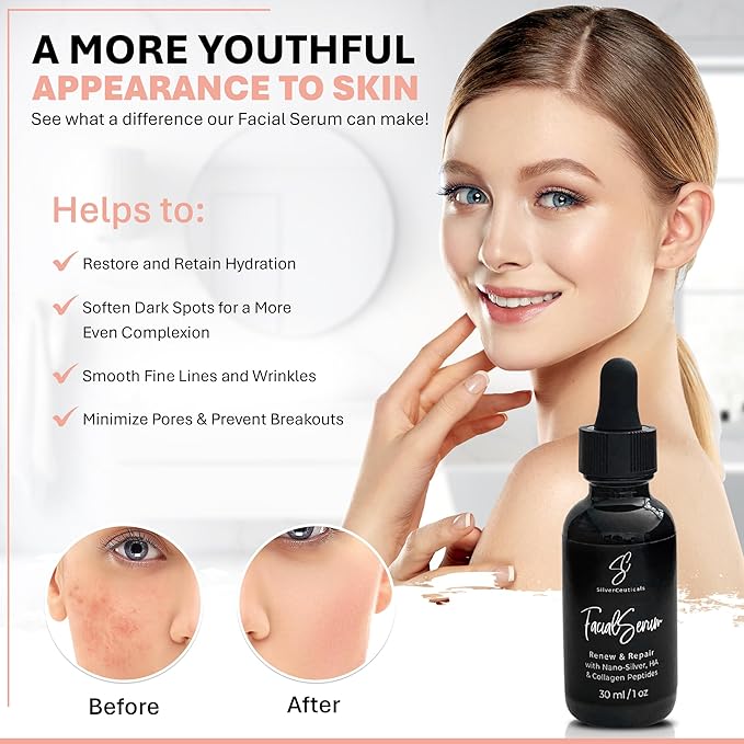 Facial Serum - Fight Blemishes - Acne Pimples & Breakouts - Soften Fine Lines & Wrinkles - Hydrate & Repair Damaged Skin - Clear Complexion - Collagen - 2 Types of Hyaluronic Acid - Anti Aging - 1oz