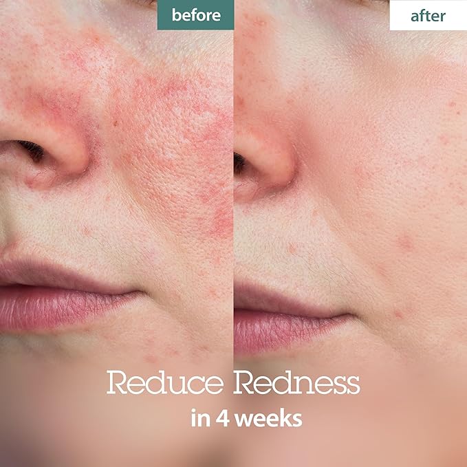 BLITHE Pressed Serum Crystal Iceplant Face Moisturizing Gel - Kbeauty Best Skin Cream for Dry Skin, Korean Serum for Combination Skin & Redness Relief, Face Moisturizer for Dry Skin Cream 1.68 Oz