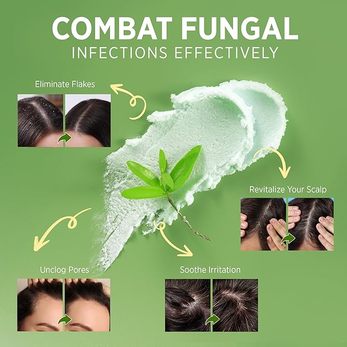 Roycederm Tea Tree Scalp Scrub: Anti Fungal Pre Shampoo, Itchy Relief Scalp Treatment for Dandruff, Psoriasis & Seborrheic Dermatitis - Gently Exfoliator, Relieves Dryness, Promotes Hair Growth