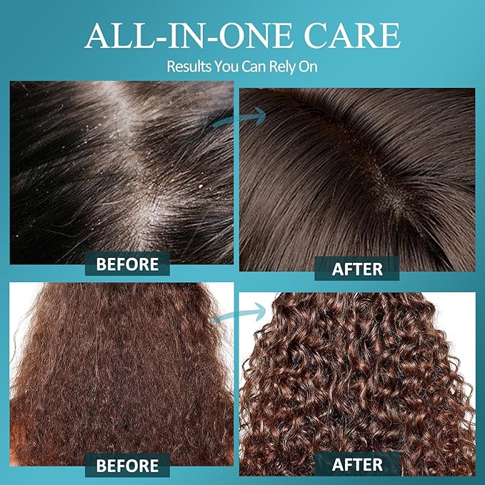 Scalp Scrub, Biotin 2-in-1 Scalp Exfoliator Scrub Clarifying Detox Shampoo with 3% Salicylic Acid & Tea Tree for Dandruff, Build Up, Itchy Scalp, Oily Hair & Dry Scalp Treatment with Scalp Massager