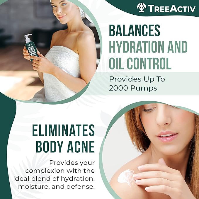 TreeActiv Acne Eliminating Body Lotion 8 fl oz | Clears Body, Back, Butt and Shoulder Acne | Anti-Acne Moisturizer | Prevents Future Breakouts | Cucumber Mint Scent
