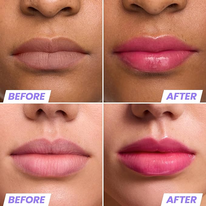 Wonderskin Lip Oil Rehab Serum - Color Changing Lip Oil from Clear to Pink - PH-activated, Non-sticky & Hydrating Tinted Serum for Dry Lips (Kissed)