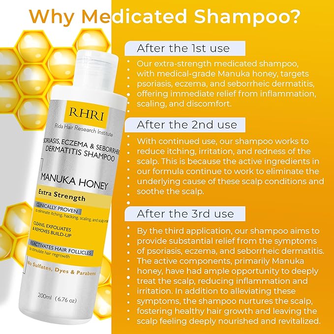 Psoriasis Shampoo for Men & Women | Itchy Scalp Treatment with Manuka Honey | Best for Eczema, Seborrheic Dermatitis, Ringworm & Folliculitis Scalp Treatment