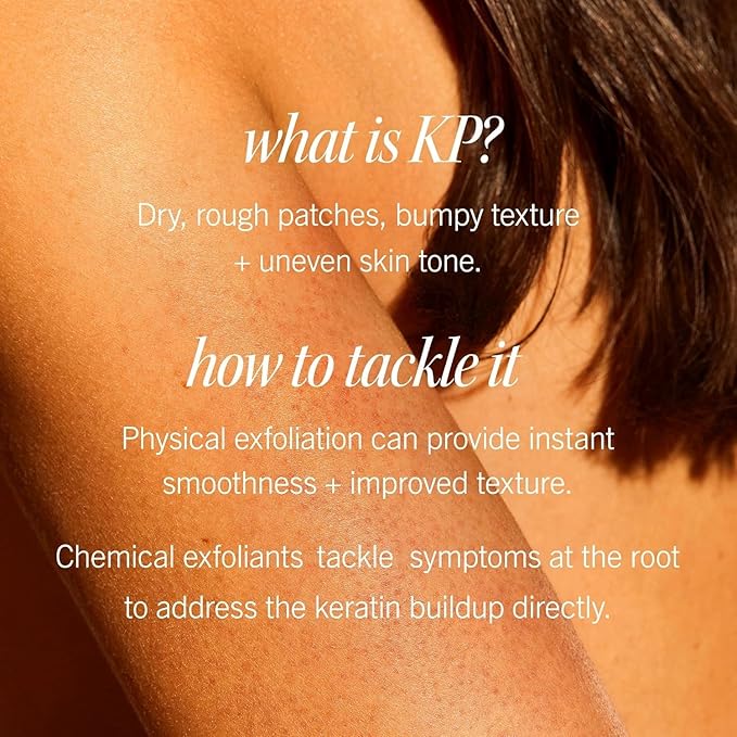 First Aid Beauty - KP Bump Eraser Body Scrub with 10% AHA, Keratosis Pilaris Exfoliator with Glycolic and Lactic acids, Helps Reduce Chicken Skin Bumps, Safe for Sensitive Skin, Strawberry Scent, 2 oz