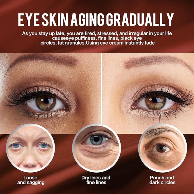 Retinol Eye Cream,Anti Aging Eye Cream, Retinol Eye Stick for Dark Circles and Puffiness Bags Treatment, Eye Balm Instantly Brighten,Under Eye Cream,Eye Cream for Wrinkles,Reduces Fine Lines