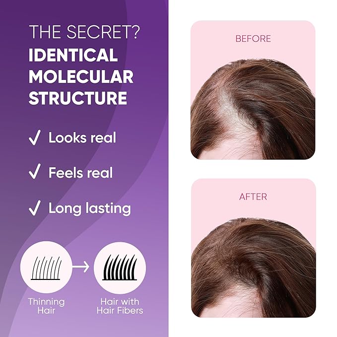 GBG Hair Fibers for Thinning Hair & Bald Spots (Dark Brown) - 25g Bottle - Conceals Hair Loss - Instant Cover Up & Volume in 30 Seconds, Hair Powder for Women & Men - Cruelty Free