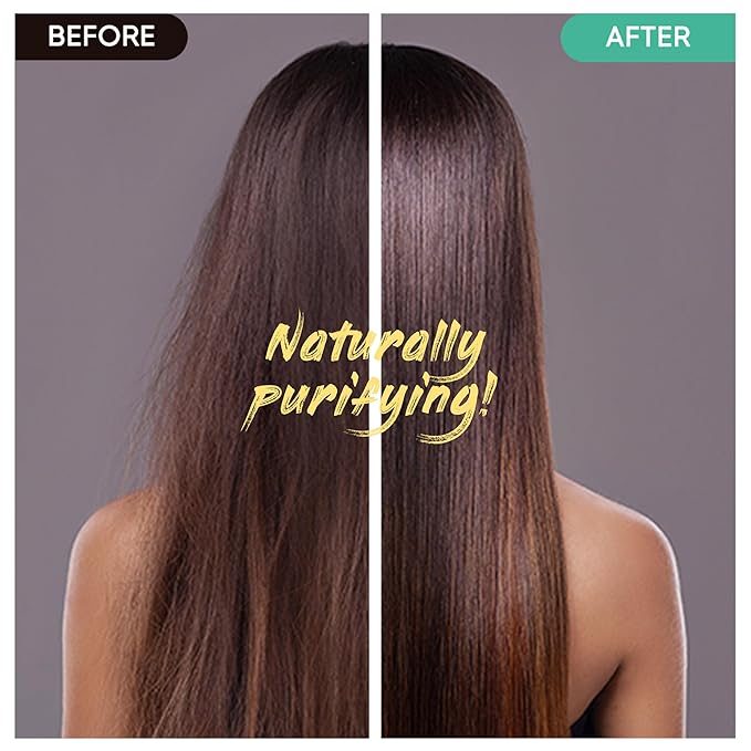 Tea Tree Shampoo Bar 2.0 - Hydrating & Moisturizing Natural Hair Soap Bar Shampoo for Excess Oil Build-Up & Scalp Nourishment - Bathing Soap Solid Shampoo for All Hair Types (120g, 4.23oz)