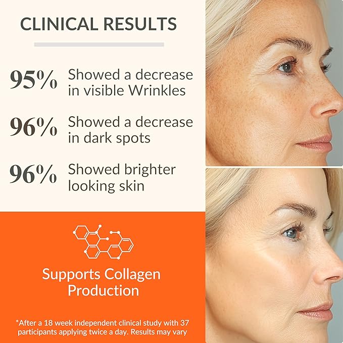 LeVaye Vitamin C Serum, Anti-Aging Face Serum – 15% Vitamin C, Ferulic Acid, Niacinamide, Hyaluronic Acid, Peptides, Ceramides – Targets Wrinkles, Fine Lines, Dark Spots, Enlarged Pores, Dry Skin