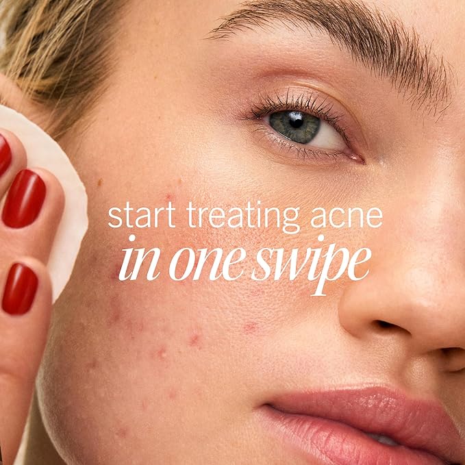 First Aid Beauty Acne Pads for Face - Maximum Strength Acne Treatment - 2% Salicylic Acid Pads Treat Without Drying, (60-ct)