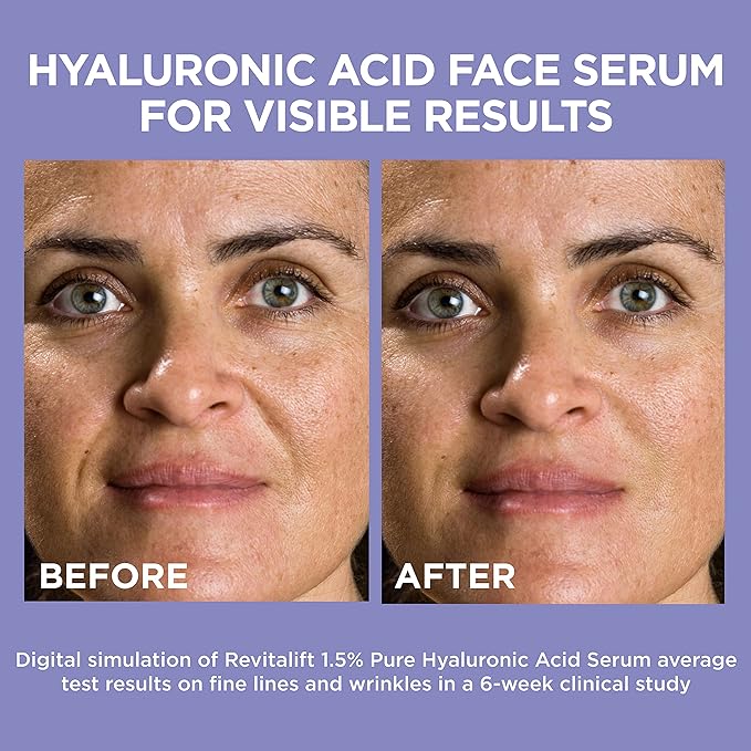 L'Oreal Paris Revitalift 1.5% Pure Hyaluronic Acid Face Serum 1.0 oz + True Match Lumi Glotion Natural Glow Enhancer Lotion, Medium 1.35 fl. oz, 1 kit