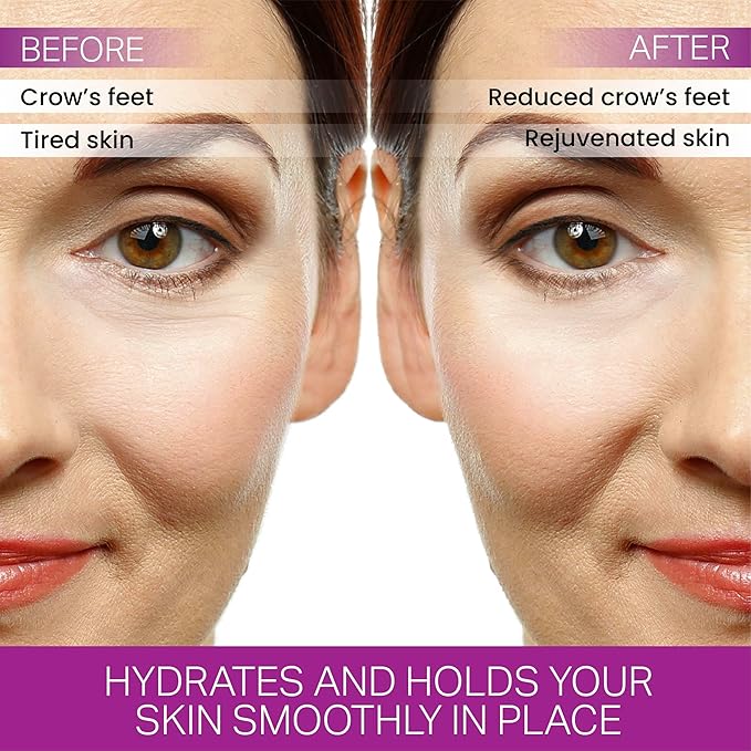 Furlesse Crows Wrinkle Patches, Overnight Eye Patches for Wrinkles and Crow’s Feet Lines, Non-invasive Anti-Wrinkle Patches, Anti-aging Skincare, 60 Patches, 30-Day Use