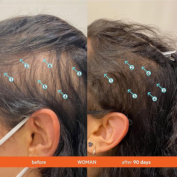 DS Labs Revita Shampoo – High-Performance Hair Density Shampoo, Volumizing & Thickening, Fuller, Healthier-Looking Hair, Sulfate & Silicone Free, For Men & Women, 500mL, Packaging May Vary