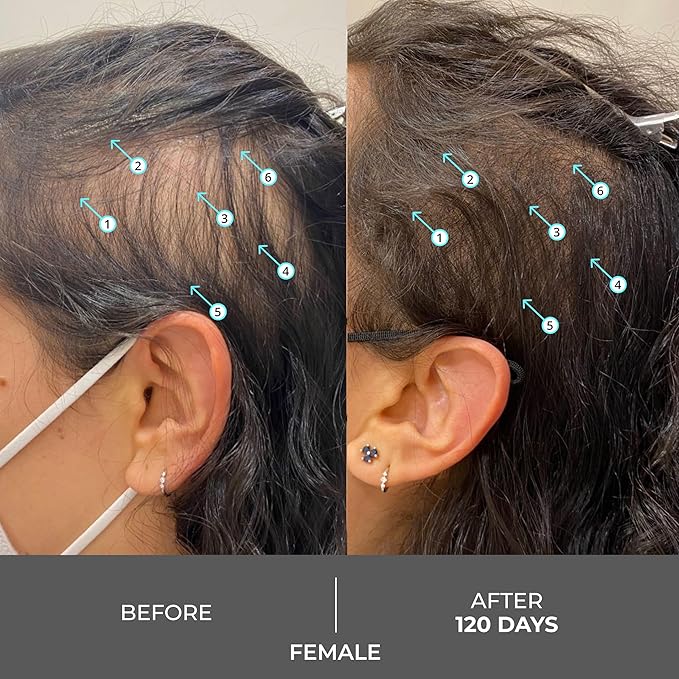 DS Labs Revita Extra Strength Shampoo - High-Performance Hair Density Shampoo, Volumizing & Thickening, Fuller Looking Hair, Saw Palmetto, Sulfate & Silicone Free, For Men & Women, 205mL