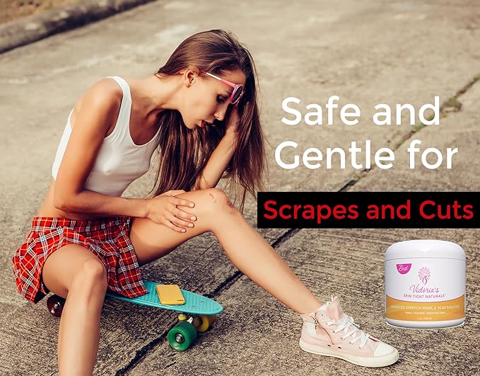 Best Stretch Marks Cream Prevent & Reduce Marks Reduce Pregnancy Stretch Marks Highly Concentrated Cream includes $29 Scar Reducing Guide