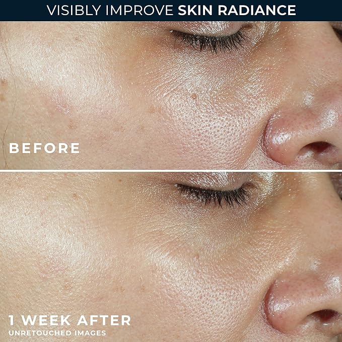 RoC Multi Correxion Revive + Glow Vitamin C Sunscreen Broad Spectrum SPF 30 Face Moisturizer (1.7 oz) with Retinol Eye Cream Packette