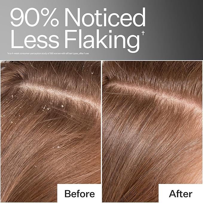 ACT+ ACRE Cold Processed Scalp Detox Oil - Sulfate-Free Care for Flaky, Dry and Itchy Scalp - Promotes Thicker, Fuller-Looking Hair